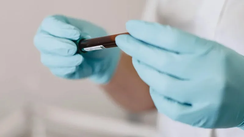 medication optimization testing